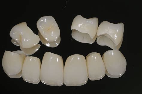 dentes de porcelana